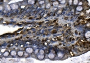 IHC staining of FFPE rat colon with MCM4 antibody. HIER: boil tissue sections in pH8 EDTA for 20 min and allow to cool before testing.