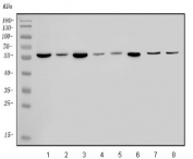 Western blot testing of 1) rat liver, 2) rat heart, 3) rat kidney, 4) mouse liver, 5) mouse kidney, 6) mouse NIH 3T3, 7) human MCF7 and 8) human HepG2 lysate with ALDH6A1 antibody. Predicted molecular weight ~58 kDa.