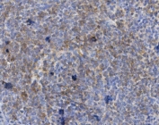 IHC staining of FFPE rat spleen with Cd72 antibody. HIER: boil tissue sections in pH8 EDTA for 20 min and allow to cool before testing.