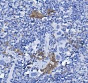 IHC staining of FFPE mouse spleen with Cd72 antibody. HIER: boil tissue sections in pH8 EDTA for 20 min and allow to cool before testing.