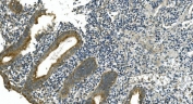 IHC staining of FFPE human appendicitis tissue with CDC123 antibody. HIER: boil tissue sections in pH8 EDTA for 20 min and allow to cool before testing.