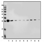 Western blot testing of human 1) K562, 2) PC-3, 3) HepG2, 4) HEK293, 5) A549, 6) U-87 MG, 7) rat liver, 8) rat kidney and 9) mouse kidney lysate with CMBL antibody. Predicted molecular weight ~28 kDa.