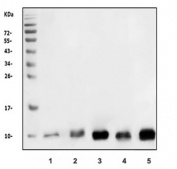 Western blot testing of 1) rat brain, 2) rat stomach, 3) rat kidney, 4) mouse brain and 5) mouse kidney lysate with Cox8a antibody. Predicted molecular weight ~8 kDa.