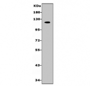 Western blot testing of rat PC-12 cell lysate with Mucin 1 antibody. Expected molecular weight: 120-500 kDa depending on glycosylation level.