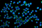 Immunofluorescent staining of FFPE mouse HEPA1-6 cells with Golph2 antibody (green) and DAPI nuclear stain (blue). HIER: steam section in pH6 citrate buffer for 20 min.