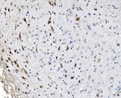 IHC staining of FFPE mouse brain with GLRX2 antibody. HIER: boil tissue sections in pH8 EDTA for 20 min and allow to cool before testing.