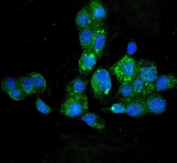 Immunofluorescent staining of FFPE human A431 cells with HYI antibody (green) and DAPI nuclear stain (blue). HIER: steam section in pH6 citrate buffer for 20 min.