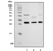 Western blot testing of 1) rat liver, 2) rat kidney and 3) mouse liver lysate with HYI antibody. Predicted molecular weight ~30 kDa.