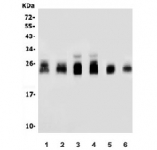 Western blot testing of mouse 1) spleen, 2) thymus, 3) RAW264.7, 4) mouse ANA-1, 5) rat spleen and 6) rat thymus lysate with Ifi30 antibody. Expected molecular weight: 33-35 kDa (pro form), 25-30 kDa (mature form), 50-60 kDa (homodimer).