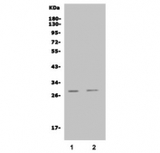 Western blot testing of rat 1) liver and 2) lung lysate with Insig1 antibody. Predicted molecular weight ~30 kDa.