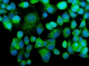 Immunofluorescent staining of FFPE human A431 cells with MEKK2 antibody (green) and DAPI nuclear stain (blue). HIER: steam section in pH6 citrate buffer for 20 min.