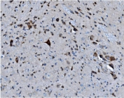 IHC staining of FFPE mouse brain with MAPK11 antibody. HIER: boil tissue sections in pH8 EDTA for 20 min and allow to cool before testing.