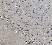 IHC staining of FFPE rat brain with MAPK11 antibody. HIER: boil tissue sections in pH8 EDTA for 20 min and allow to cool before testing.