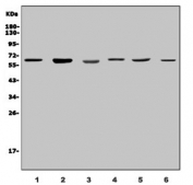 Western blot testing of 1) rat testis and human 2) HEK293, 3) HL60, 4) U-2 OS, 5) HepG2 and 6) A431 lysate with PARP2 antibody. Predicted molecular weight ~66 kDa.