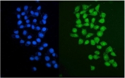 Immunofluorescent staining of FFPE human HepG2 cells with PARP2 antibody (green) and DAPI nuclear stain (blue). HIER: steam section in pH6 citrate buffer for 20 min.