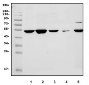 Western blot testing of 1) human T-47D, 2) human MCF7, 3) human HeLa, 4) rat heart and 5) mouse kidney lysate with RGS6 antibody. Predicted molecular weight ~54 kDa.