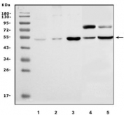 Western blot testing of 1) mouse kidney, 2) mouse skeletal muscle, 3) mouse heart, 4) rat heart and 5) rat kidney lysate with Slc14a1 antibody. Predicted molecular weight: 42-54 kDa depending on glycosylation level.