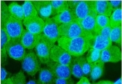 Immunofluorescent staining of FFPE human A431 cells with SORD antibody (green) and DAPI nuclear stain (blue). HIER: steam section in pH6 citrate buffer for 20 min.