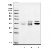 Western blot testing of human 1) K562, 2) HT1080 and 3) HepG2 lysate with DR5 antibody. Expected molecular weight: ~40 kDa (mature form) and ~48 kDa (precursor). This protein may also be visualized at ~60 kDa.