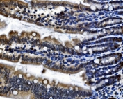 IHC staining of FFPE mouse intestine with CDC27 antibody. HIER: boil tissue sections in pH8 EDTA for 20 min and allow to cool before testing.