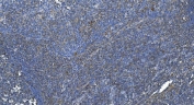 IHC staining of FFPE human tonsil with Diacylglycerol kinase zeta antibody. HIER: boil tissue sections in pH8 EDTA for 20 min and allow to cool before testing.