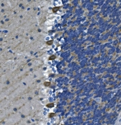 IHC staining of FFPE mouse brain tissue with Diacylglycerol kinase zeta antibody. HIER: boil tissue sections in pH8 EDTA for 20 min and allow to cool before testing.