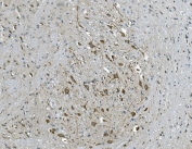 IHC staining of FFPE mouse brain tissue with GABRG2 antibody. HIER: boil tissue sections in pH8 EDTA for 20 min and allow to cool before testing.
