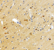 IHC staining of FFPE human brain tissue with GABRG2 antibody. HIER: boil tissue sections in pH8 EDTA for 20 min and allow to cool before testing.