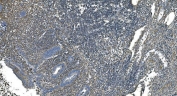 IHC staining of FFPE human appendicitis tissue with GNG2 antibody. HIER: boil tissue sections in pH8 EDTA for 20 min and allow to cool before testing.
