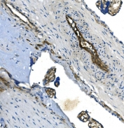 IHC staining of FFPE human placenta with GNG11 antibody. HIER: boil tissue sections in pH8 EDTA for 20 min and allow to cool before testing.