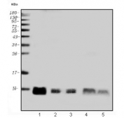 Western blot testing of 1) human placenta, 2) rat kidney, 3) mouse kidney, 4) human SH-SY5Y and 5) human A459 lysate with GNG11 antibody. Predicted molecular weight ~10 kDa.