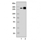 Western blot testing of mouse 1) spleen and 2) lung tissue lysate with Itgax antibody. Expected molecular weight: 128-150 kDa.