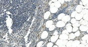 IHC staining of FFPE human appendicitis tissue with LSM5 antibody. HIER: boil tissue sections in pH8 EDTA for 20 min and allow to cool before testing.