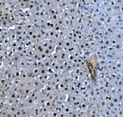 IHC staining of FFPE rat liver with LSM5 antibody. HIER: boil tissue sections in pH8 EDTA for 20 min and allow to cool before testing.