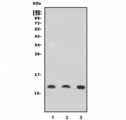Western blot testing of human 1) HL60, 2) K562 and 3) MCF7 cell lysate with LSM5 antibody. Predicted molecular weight ~12 kDa.