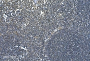 IHC staining of FFPE human tonsil with LSM7 antibody. HIER: boil tissue sections in pH8 EDTA for 20 min and allow to cool before testing.