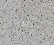IHC staining of FFPE mouse brain with LSM7 antibody. HIER: boil tissue sections in pH8 EDTA for 20 min and allow to cool before testing.