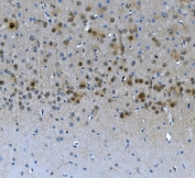 IHC staining of FFPE rat brain with LSM7 antibody. HIER: boil tissue sections in pH8 EDTA for 20 min and allow to cool before testing.
