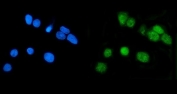 Immunofluorescent staining of FFPE human MCF7 cells with LSM7 antibody (green) and DAPI nuclear stain (blue). HIER: steam section in pH6 citrate buffer for 20 min.