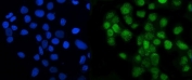 Immunofluorescent staining of FFPE human A431 cells with LSM8 antibody (green) and DAPI nuclear stain (blue). HIER: steam section in pH6 citrate buffer for 20 min.