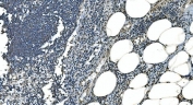 IHC staining of FFPE human appendicitis tissue with LSM8 antibody. HIER: boil tissue sections in pH8 EDTA for 20 min and allow to cool before testing.