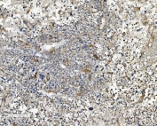 IHC staining of FFPE human liver with NDUFB2 antibody. HIER: boil tissue sections in pH8 EDTA for 20 min and allow to cool before testing.