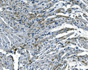 IHC staining of FFPE rat heart with NDUFB5 antibody. HIER: boil tissue sections in pH8 EDTA for 20 min and allow to cool before testing.