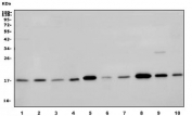 Western blot testing of human 1) HeLa, 2) MCF7, 3) ThP-1, 4) A431, 5) rat heart, 6) rat kidney, 7) rat liver, 8) mouse heart, 9) mouse kidney and 10) mouse liver lysate with NDUFB5 antibody. Predicted molecular weight ~22 kDa (isoform 1), ~16 kDa (isoform 2).