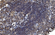 IHC staining of FFPE human appendicitis tissue with OTULIN antibody. HIER: boil tissue sections in pH8 EDTA for 20 min and allow to cool before testing.