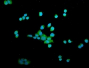 Immunofluorescent staining of FFPE human SiHa cells with OTULIN antibody (green) and DAPI nuclear stain (blue). HIER: steam section in pH6 citrate buffer for 20 min.