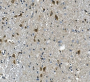 IHC staining of FFPE mouse brain with Par4 antibody. HIER: boil tissue sections in pH8 EDTA for 20 min and allow to cool before testing.
