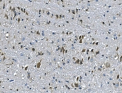 IHC staining of FFPE mouse brain with Par4 antibody. HIER: boil tissue sections in pH8 EDTA for 20 min and allow to cool before testing.