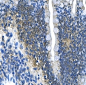 IHC staining of FFPE rat intestine with Par4 antibody. HIER: boil tissue sections in pH8 EDTA for 20 min and allow to cool before testing.