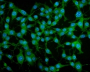 Immunofluorescent staining of FFPE mouse MFC cells (mouse forestomach carcinoma) with Par4 antibody (green) and DAPI nuclear stain (blue). HIER: steam section in pH6 citrate buffer for 20 min.